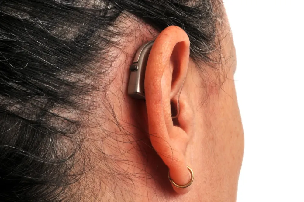 appareil d'audition